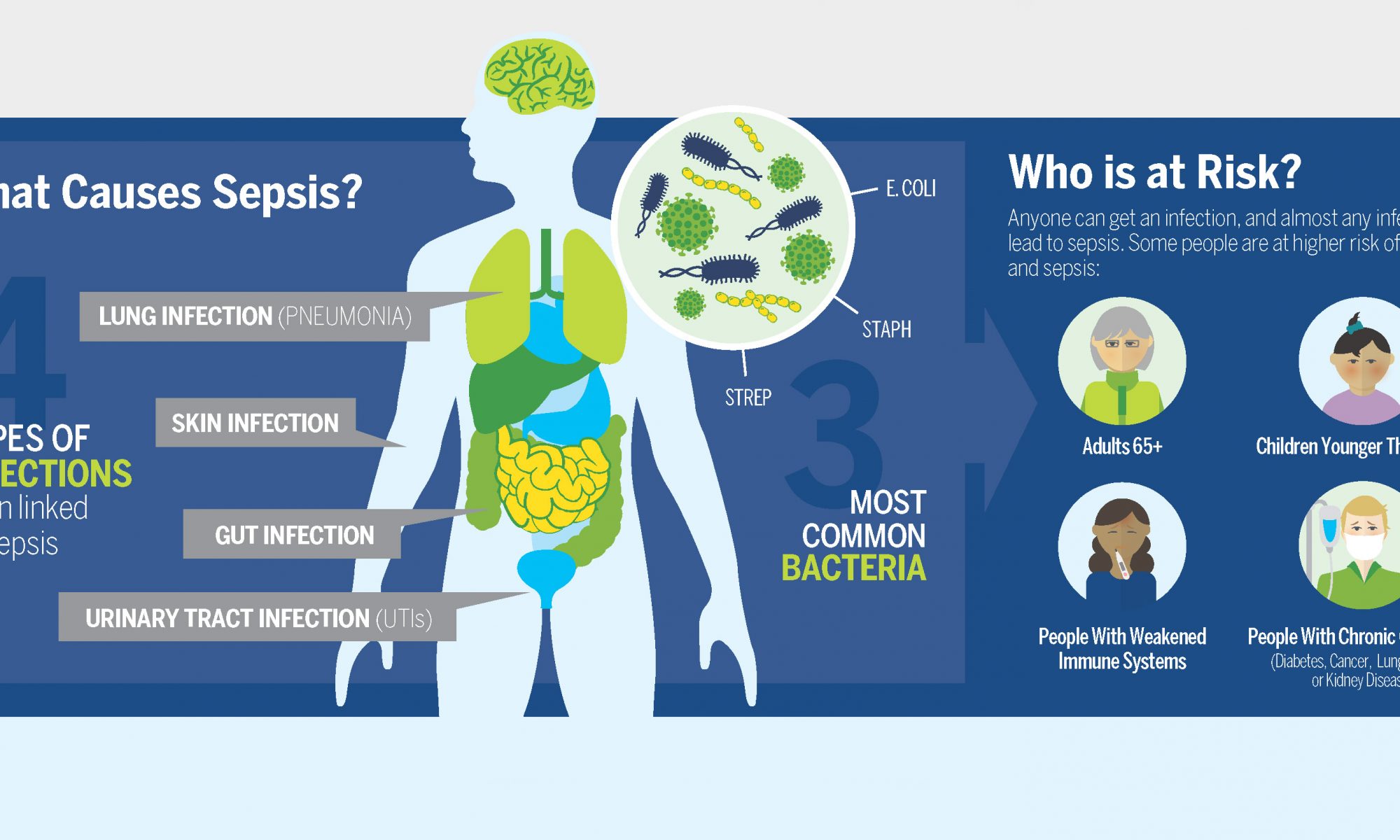 Types Of Sepsis Infection