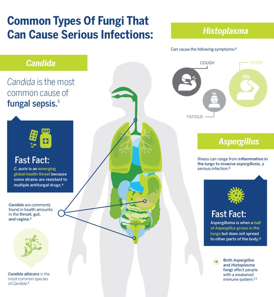 Invasive Fungal Infections Can Lead To Sepsis And Have A High Mortality 